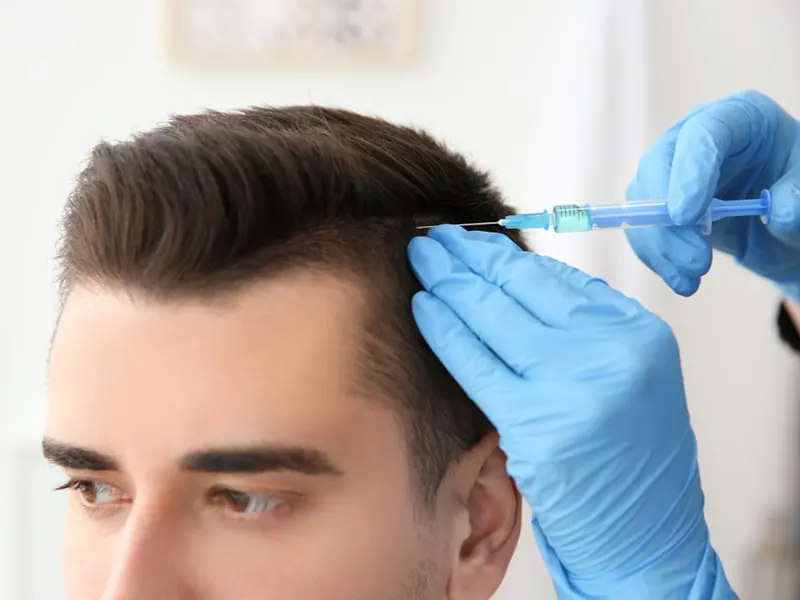 Hair restoration procedure on a man's hairline