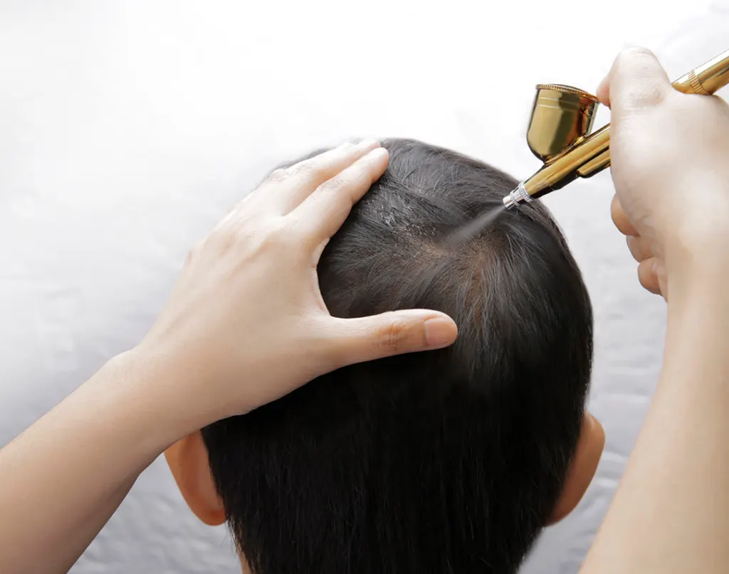 Scalp treatment for hair fall and regrowth at Periwinkle Clinic